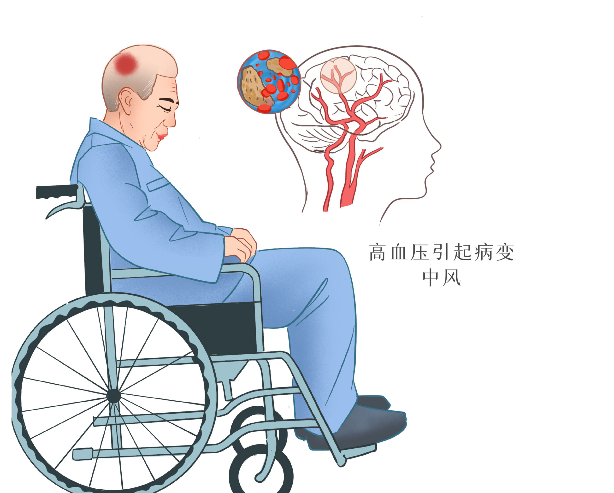 Chronic low-grade systemic inflammation